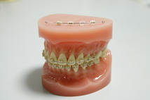 セラミックブラケット／硬質レジンブラケット