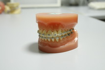 金属製ブラケット