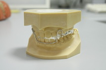 FKO（エフカオー）